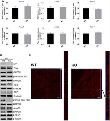 Loss of Unconventional Myosin VI Affects cAMP/PKA Signaling in Hindlimb Skeletal Muscle in an Age-Dependent Manner